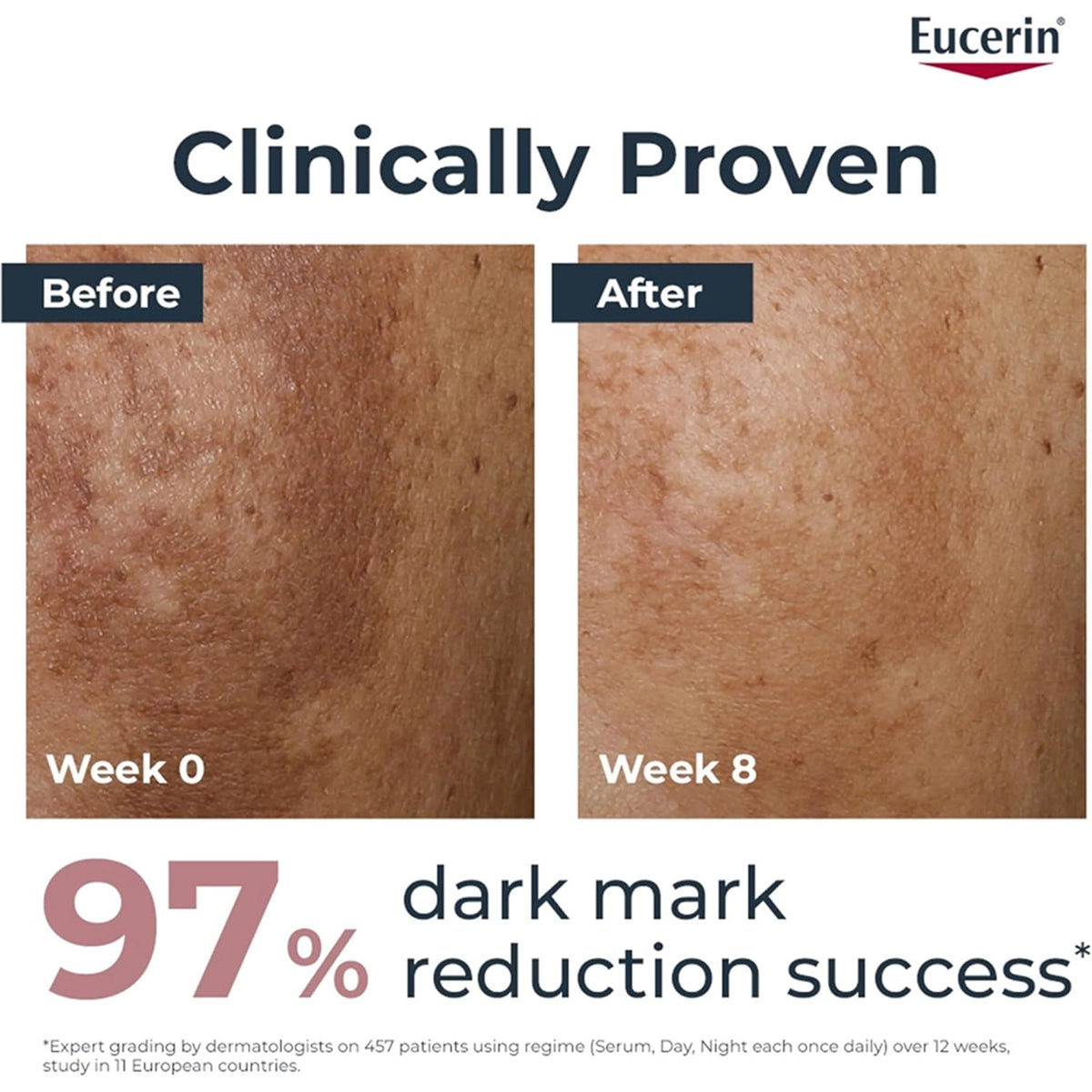 يوسيرين إيفن بيغمنت بيرفكتور كريم العناية النهارية مع (SPF30 )-50مل